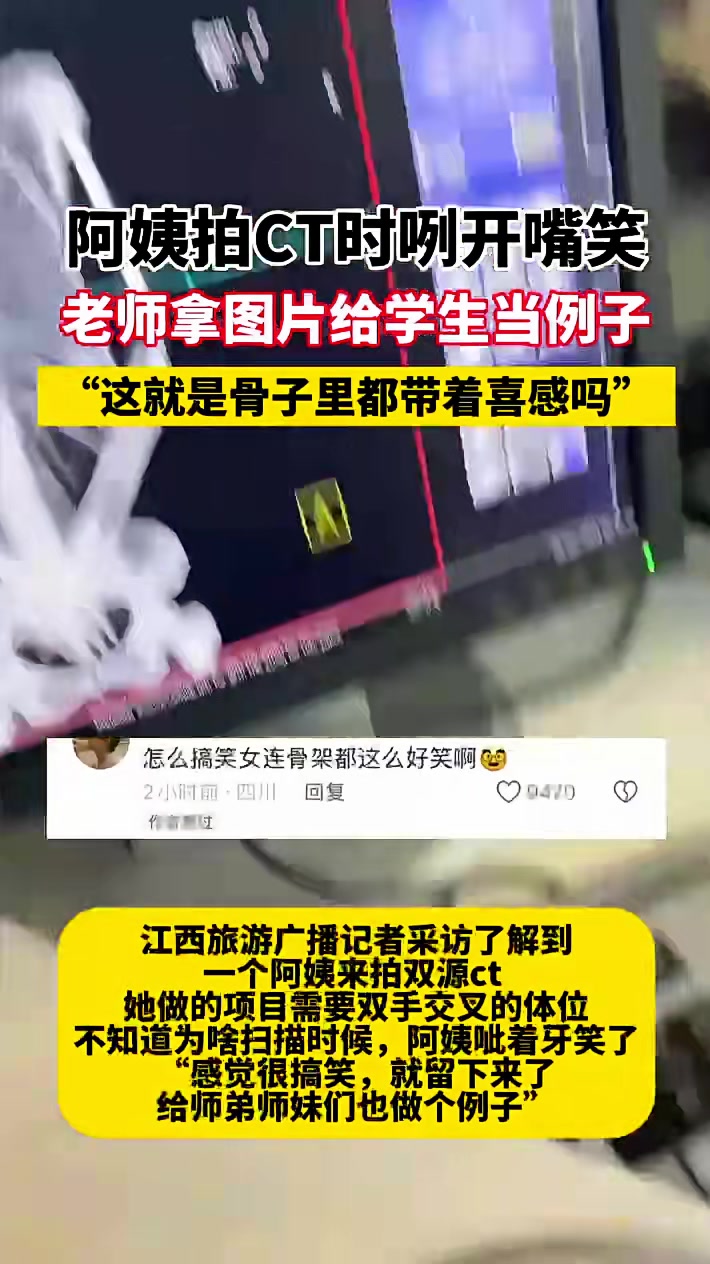 阿姨拍CT时咧开嘴笑老师那图片给学生当例子