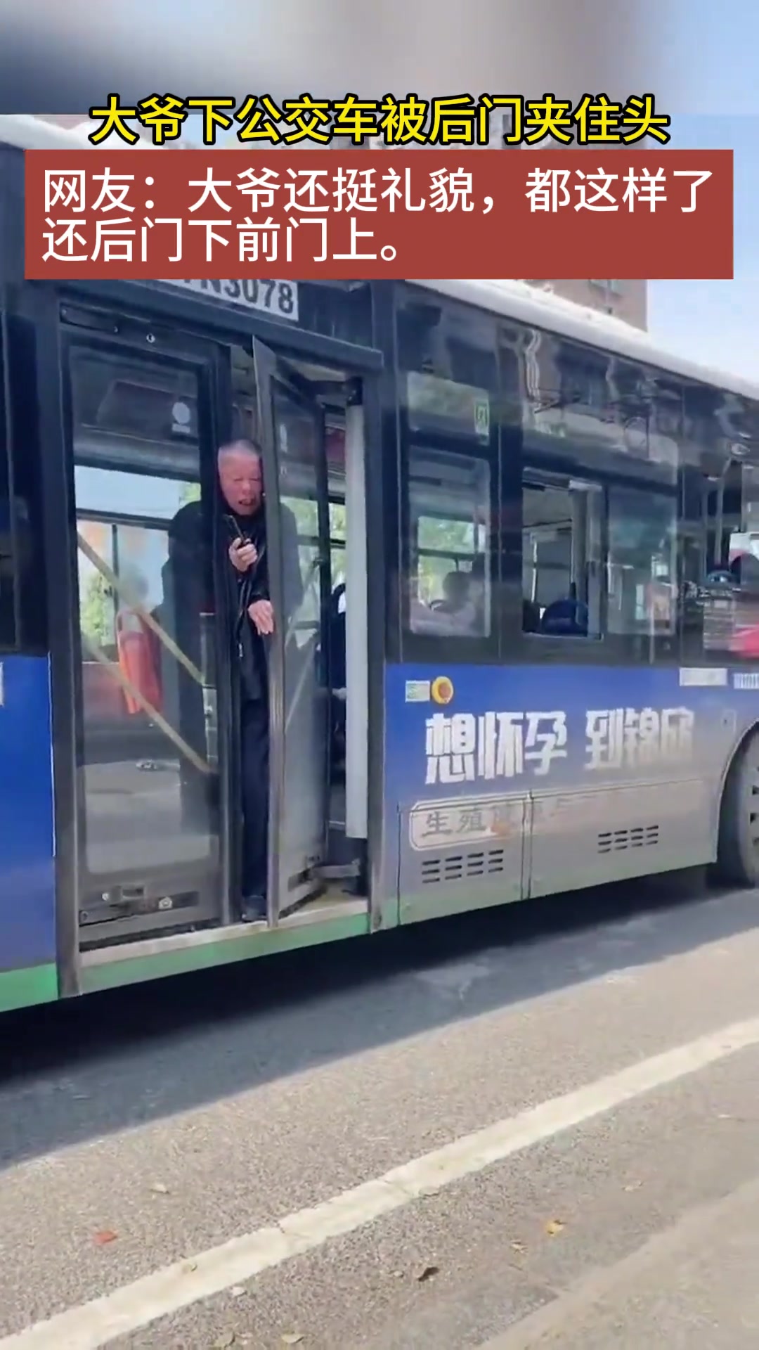 这是真”脑袋被门夹了”