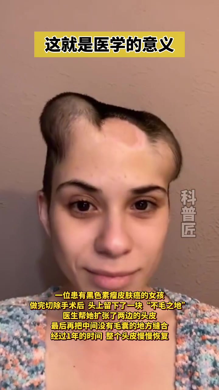 看到最后，这就是医学的意义！