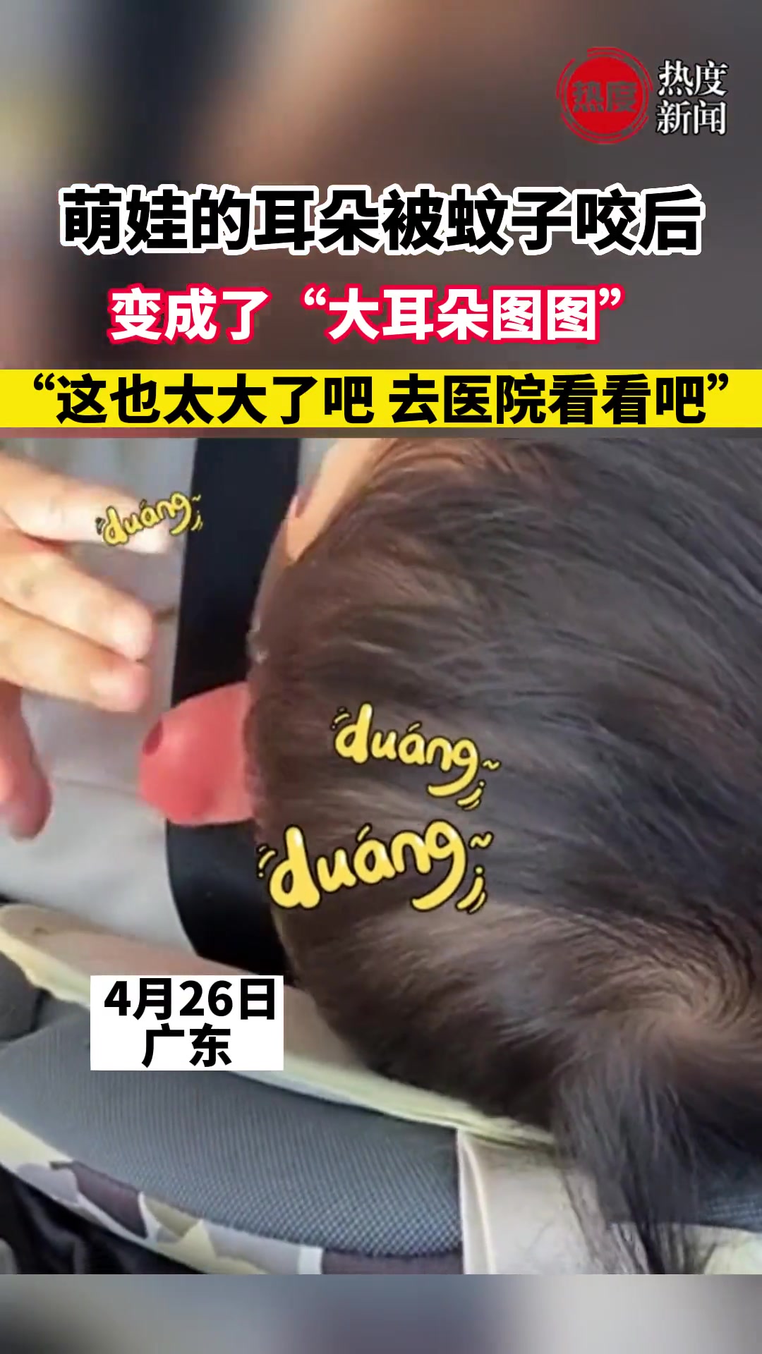 萌娃的耳朵被蚊子咬后，变成了“大耳朵图图”