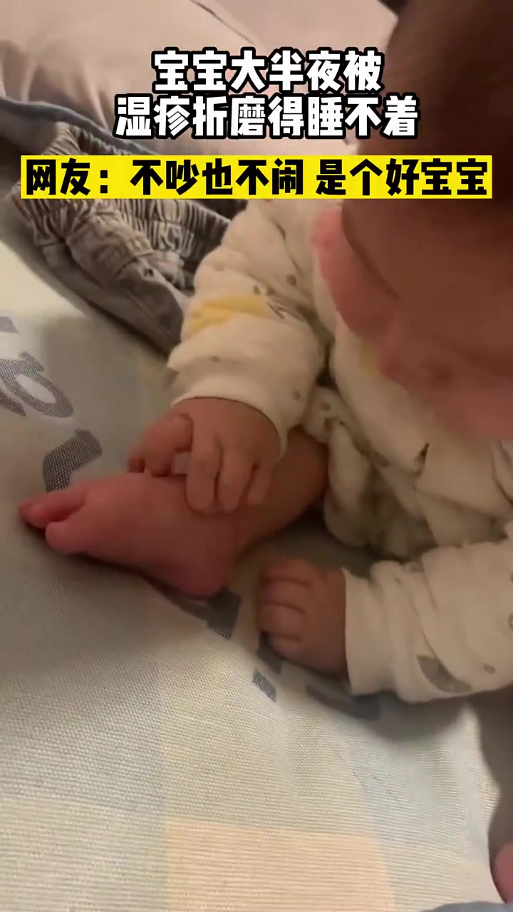 这是父母哪个给孩子传染的脚气
