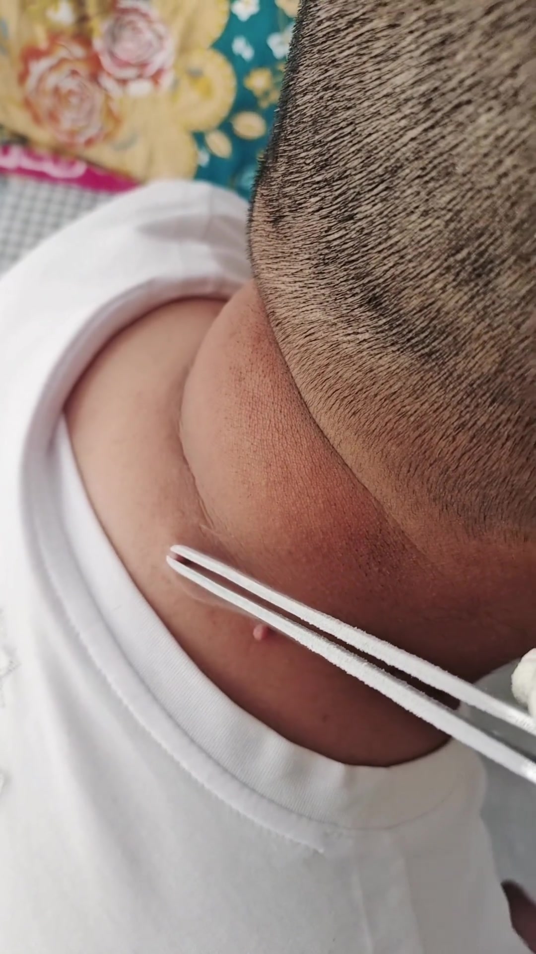 这是直接把它们烫熟吗？