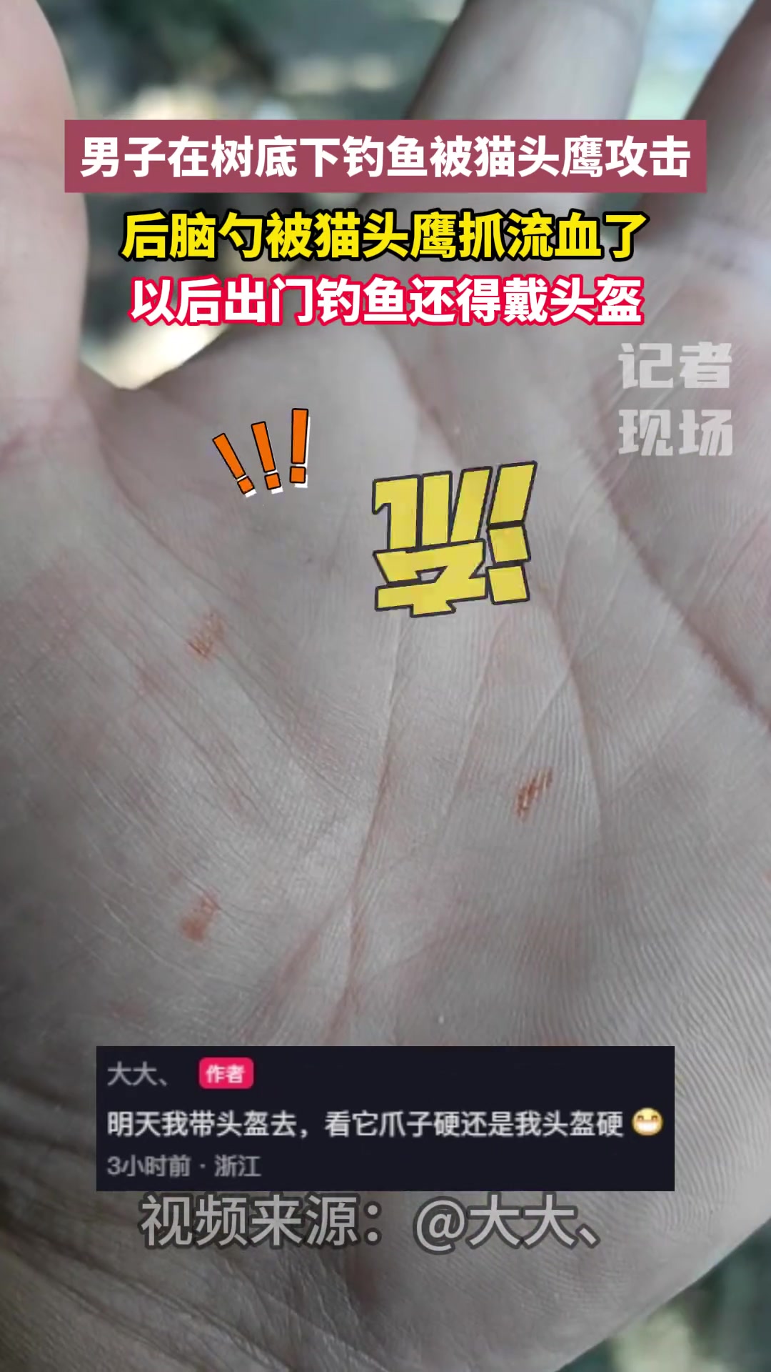 男子在树底下钓鱼被猫头鹰攻击，后脑勺被抓流血