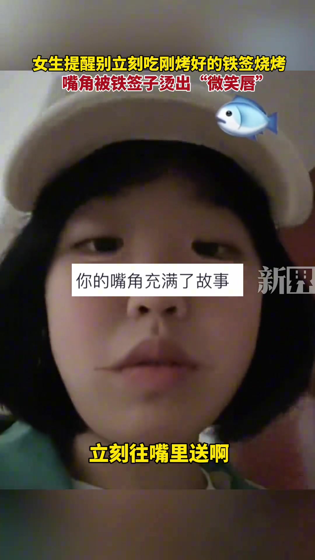 别立刻吃刚烤好的铁签烧烤，嘴角被铁签子烫出“微笑唇