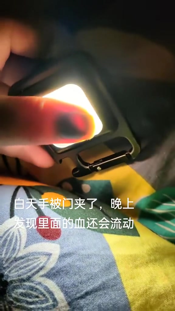 白天手被门夹了，晚上发现里面的血还会流动