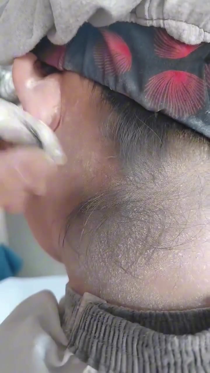 好家伙，拔鸡毛都没有这么利索