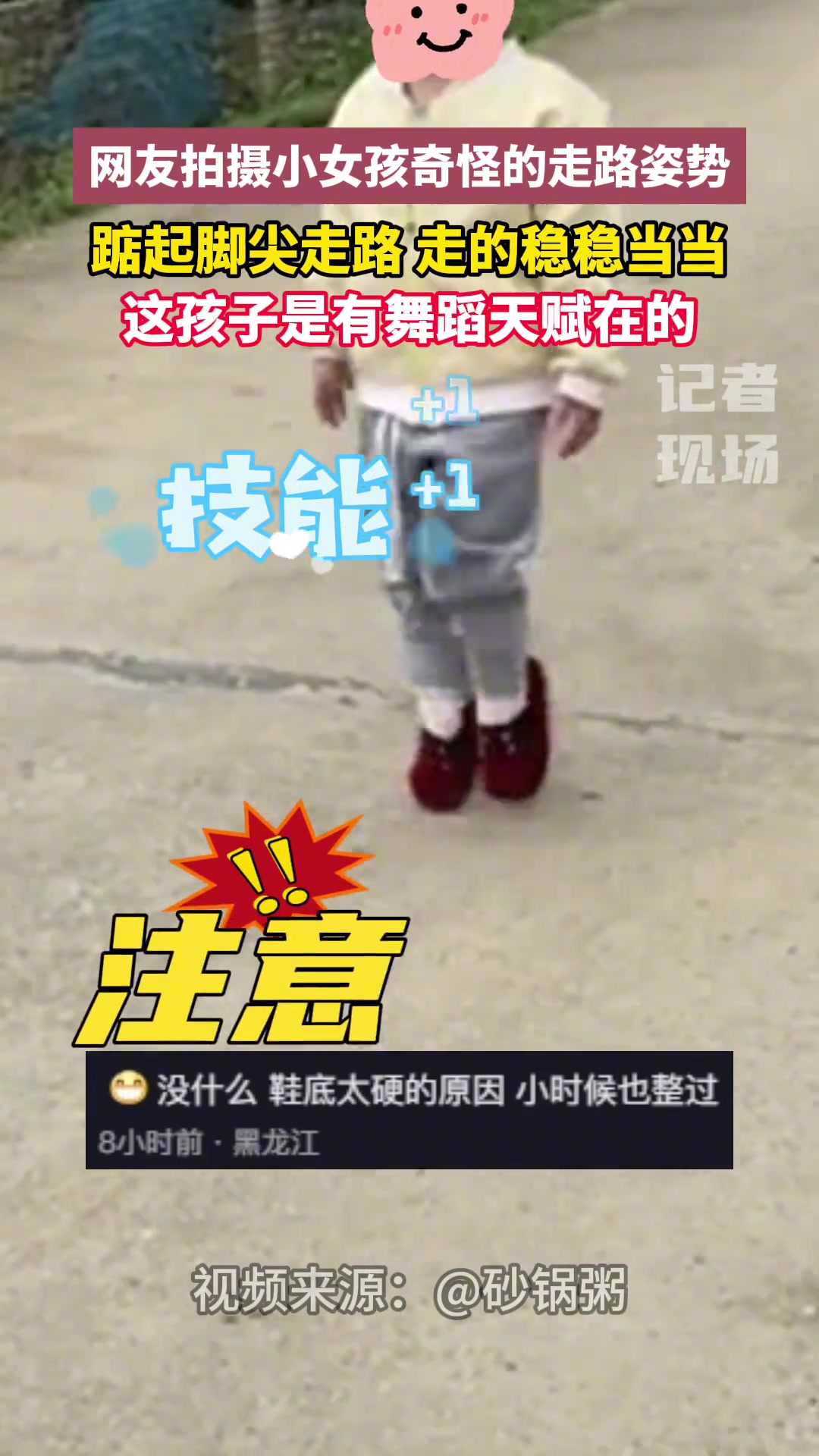 啥技能？小女孩踮起脚尖稳稳当当走路甚至还能跑