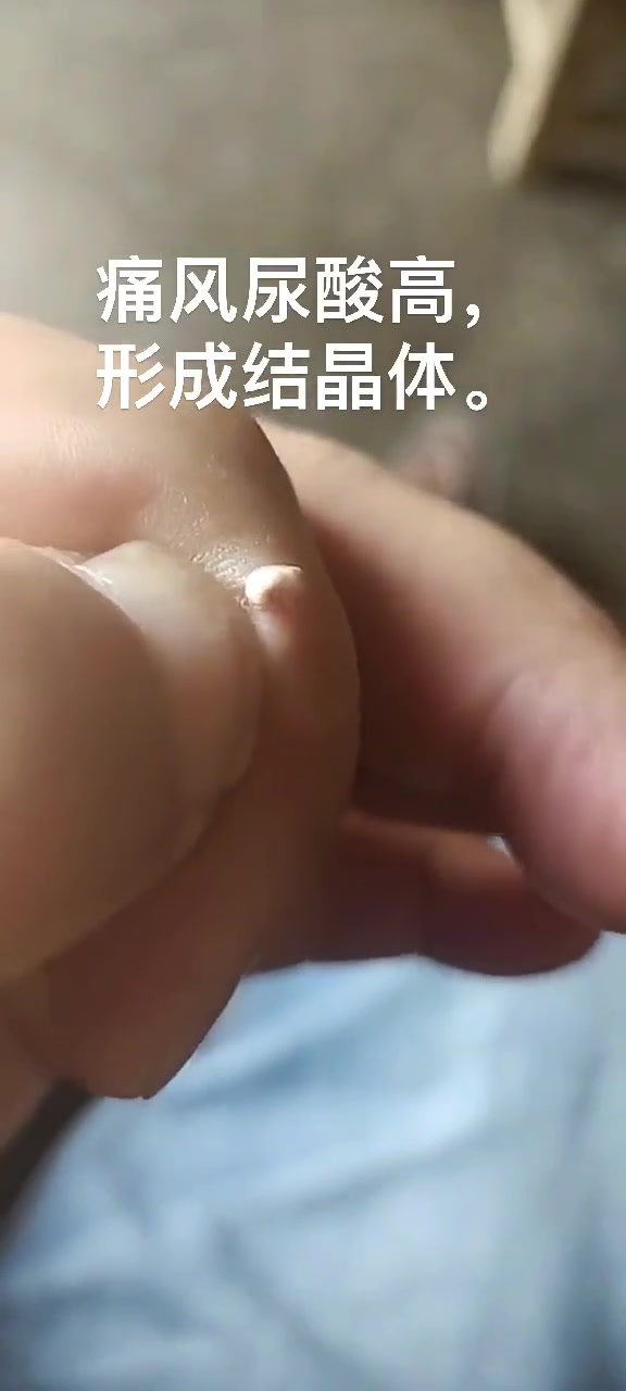 看完这个视频你还敢酗酒吗？