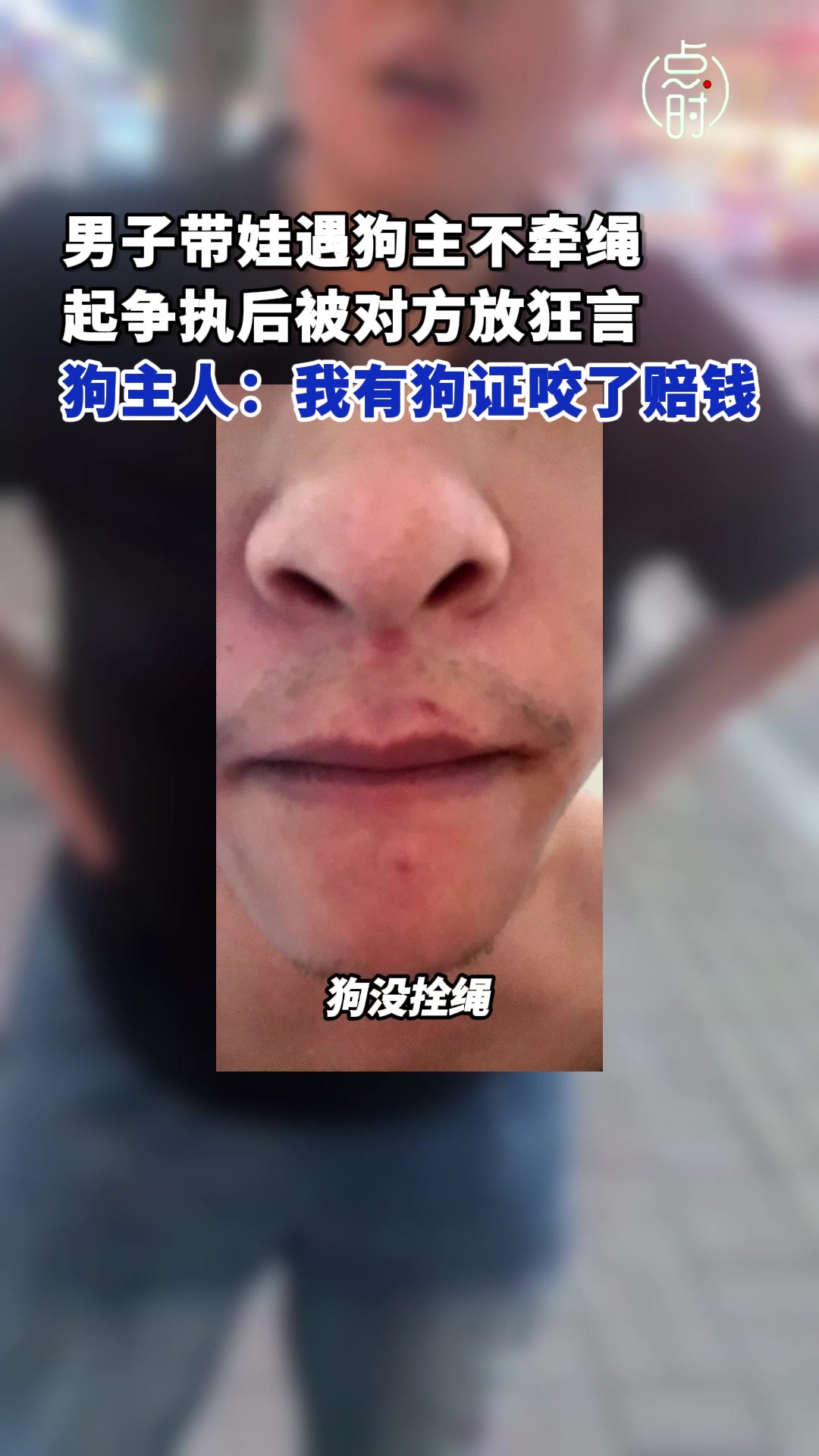 一边是不拴绳，一边是乱踢，你怎么看？