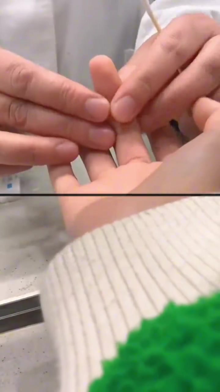 护士：是那个我能不知道吗，冒昧的家伙