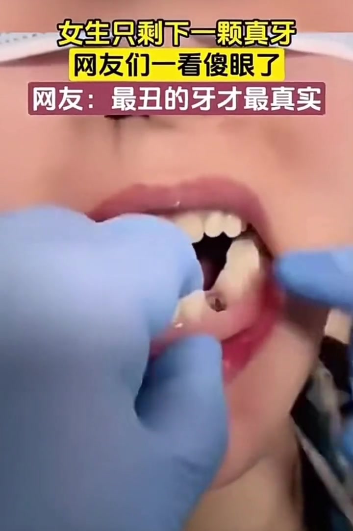 做梦也没想到 最丑的牙才最真实