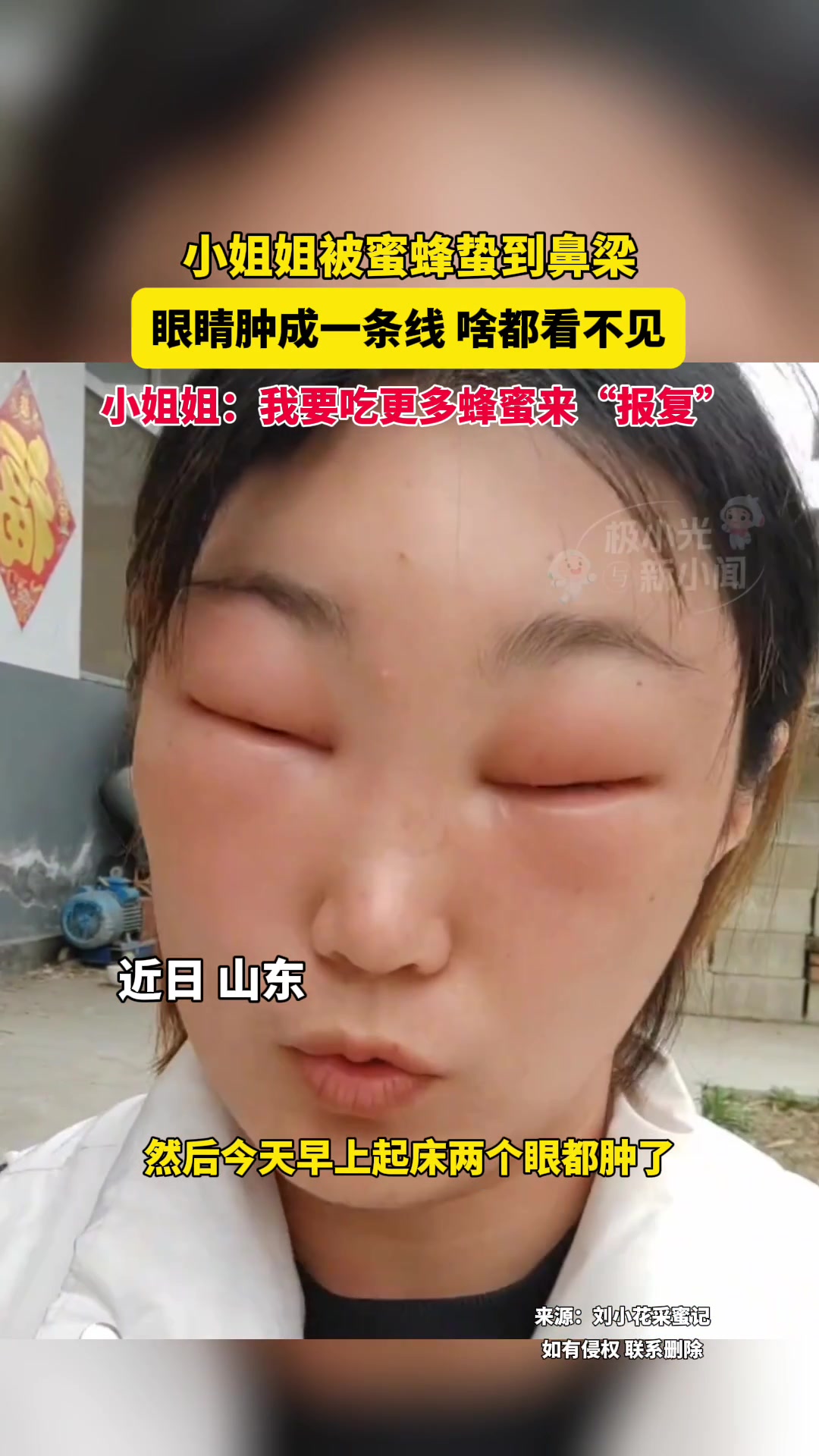 《眼睛一条线 啥都看不见》