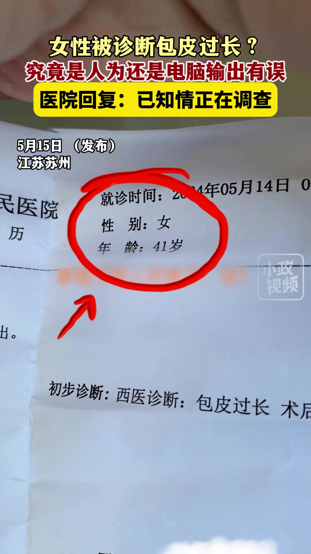 女性被医院诊断包皮过长？？