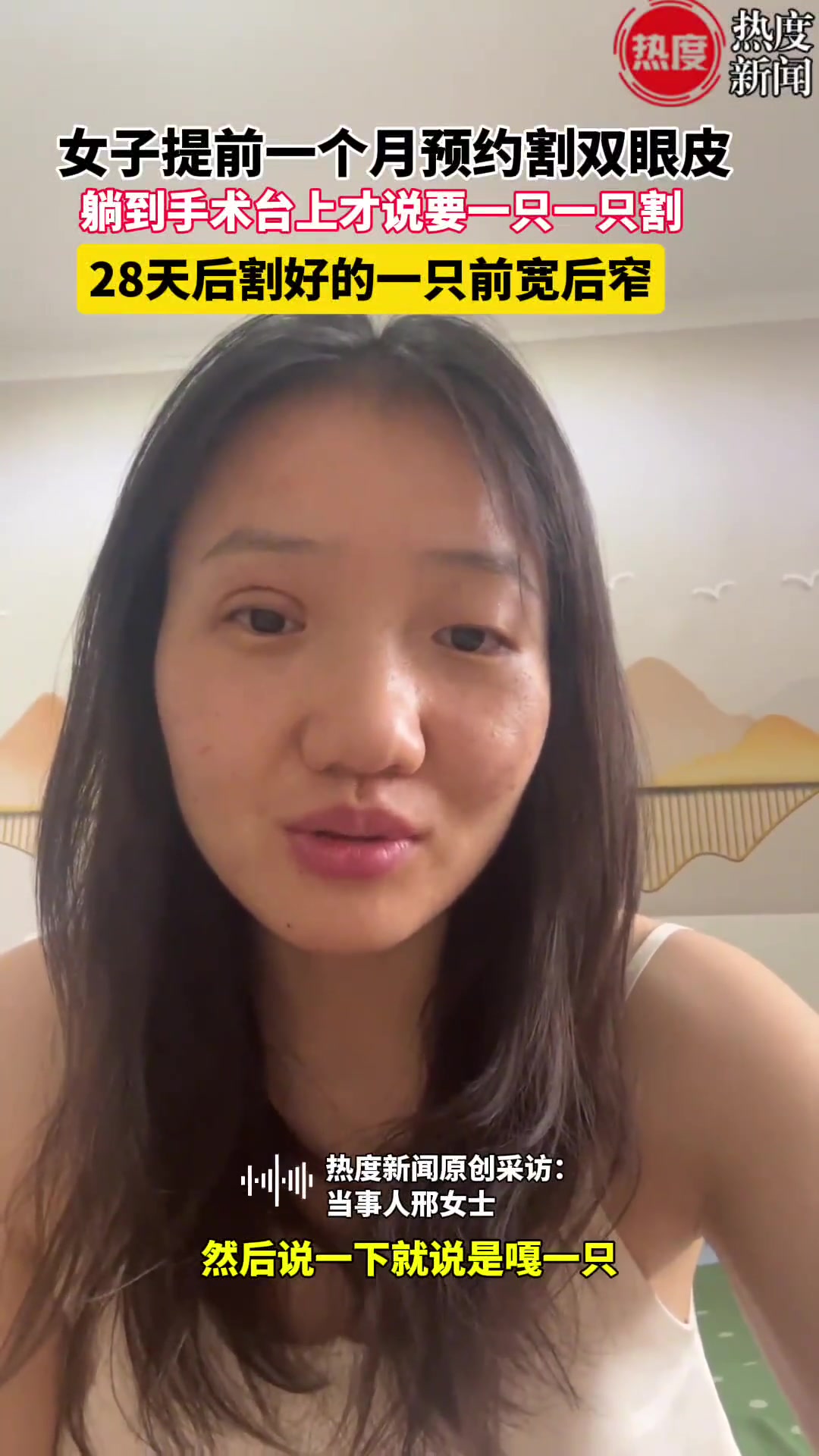 女子割双眼皮不能同时割，然后就出现这样的画面..