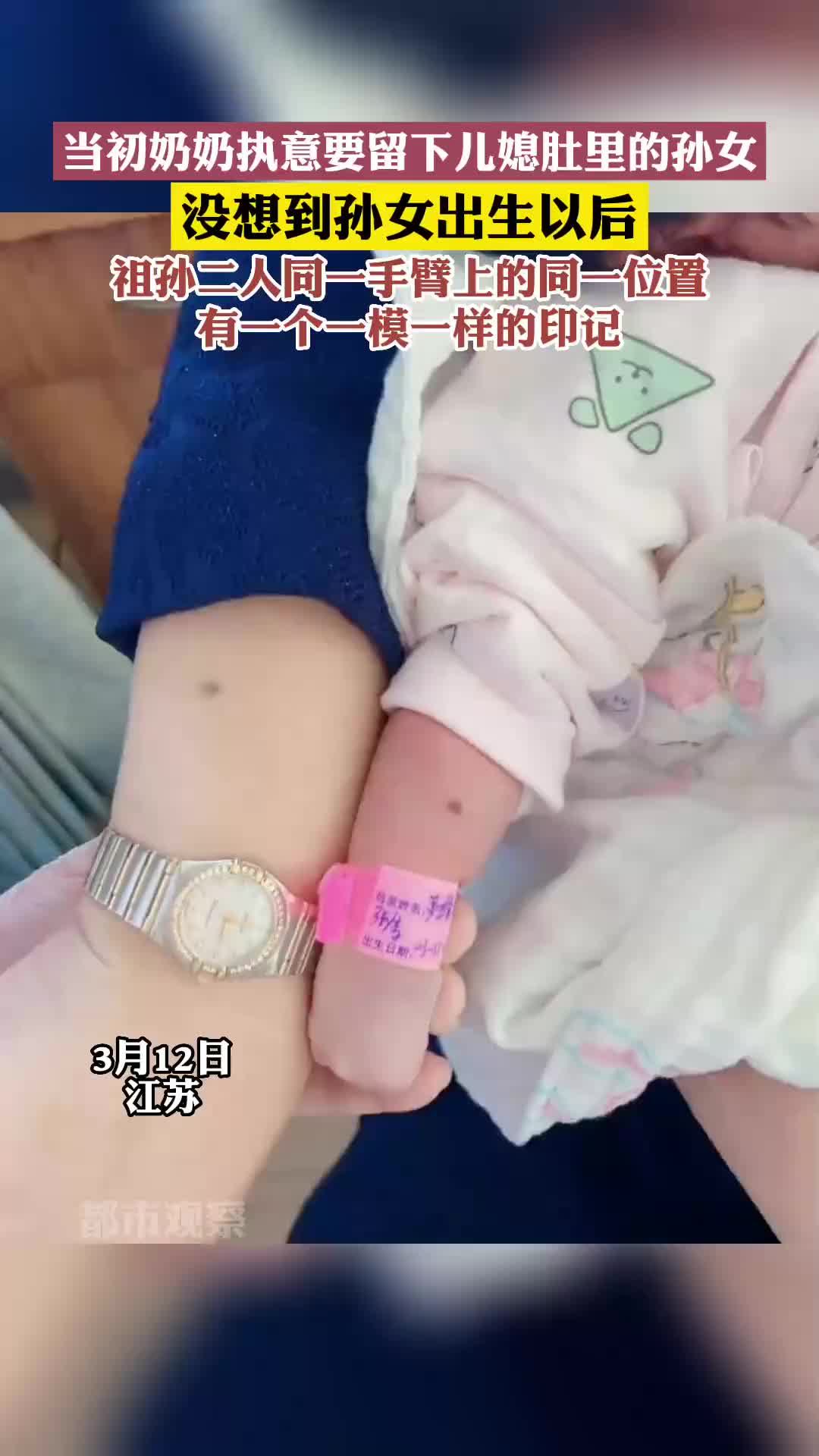 神奇！祖孙二人同一位置，有一个一模一样的印记！