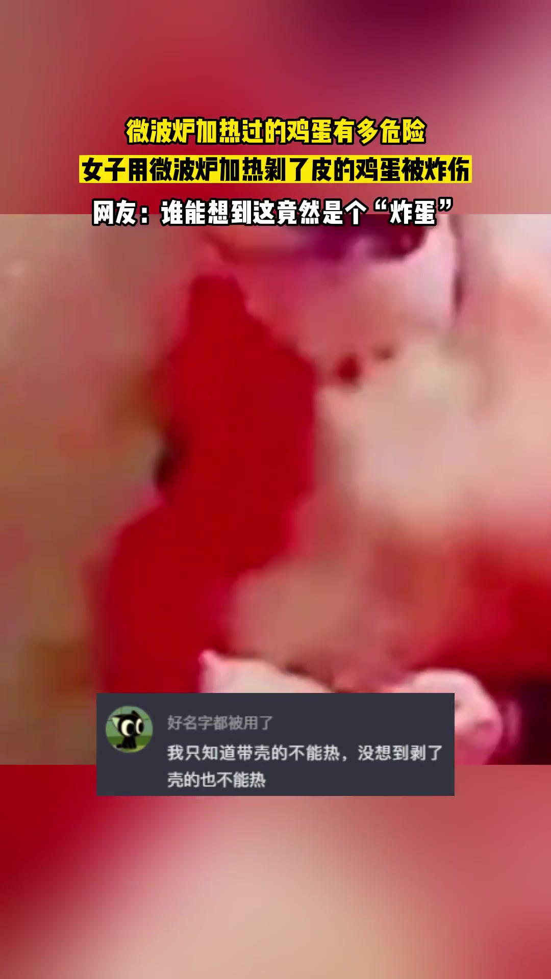 惊险！女子用微波炉加热剥了皮的鸡蛋 食用时突然爆裂