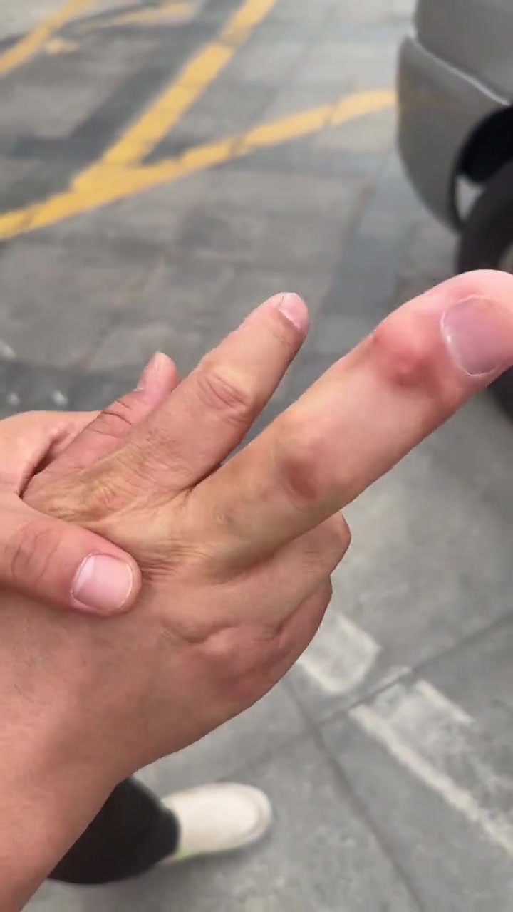 以为拿脚趾唬我呢，原来真是手指啊？超级加倍中指