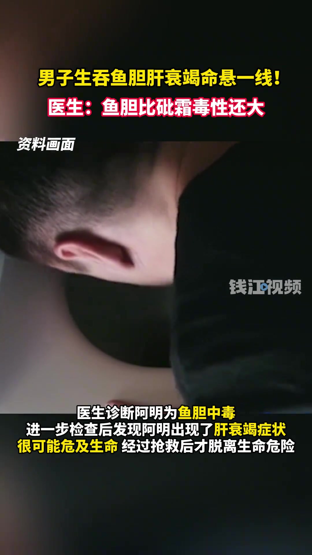 比砒霜毒性还大！男子生吃鱼胆肝衰竭送医抢救