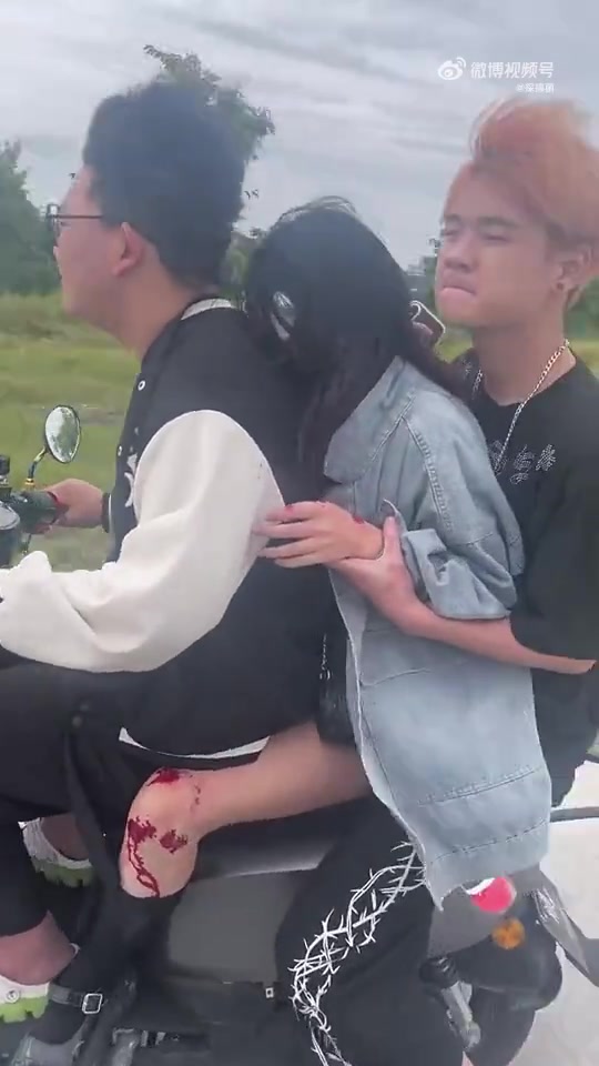 战损版精神小妹？