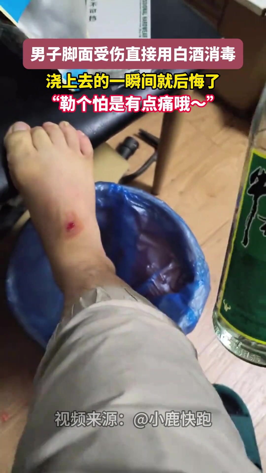 男子脚面受伤直接用白酒消毒 浇上去的一瞬间就后悔了