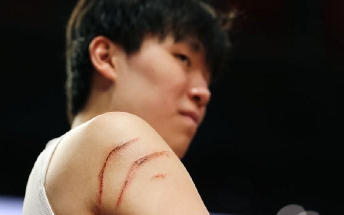 太拼了！杨瀚森与火箭内线肉搏缠斗，右臂出现两道大血印