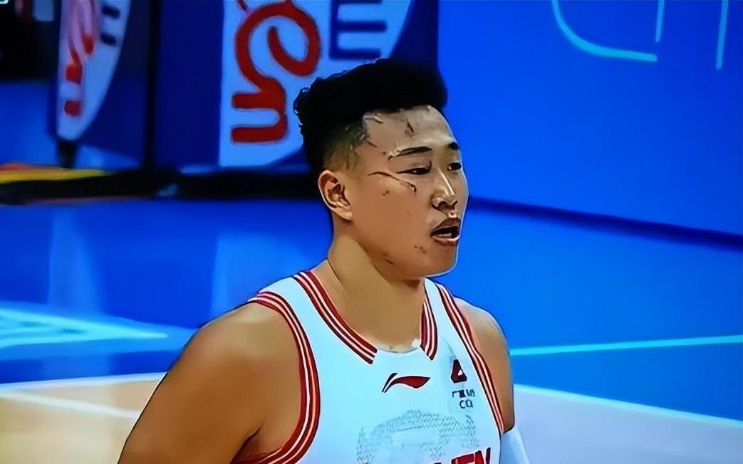 CBA真硬汉！脸部受伤眼都肿了还在场上拼，媒体和球迷：令人敬佩